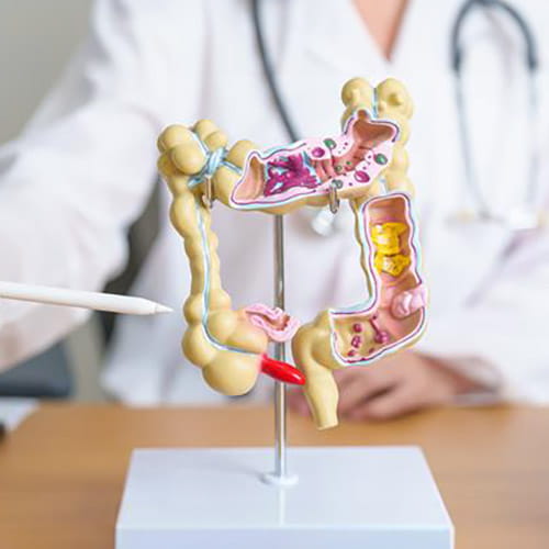 Doctor pointing to a model of a colon